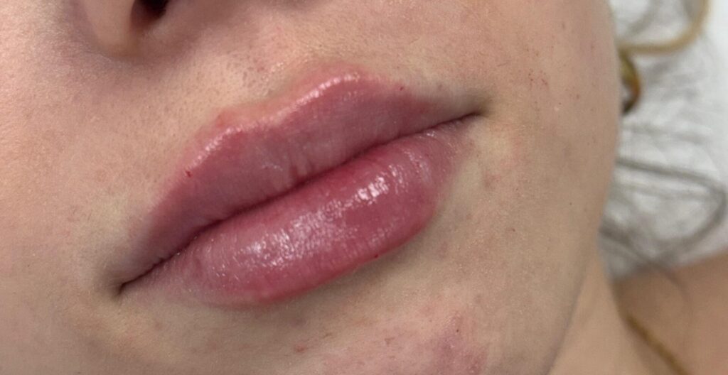 Hidratación de labios