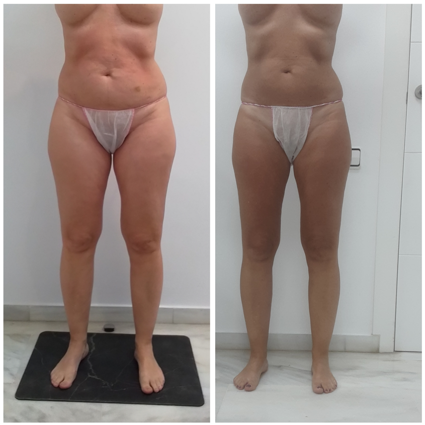 eliminar grasa abdominal 