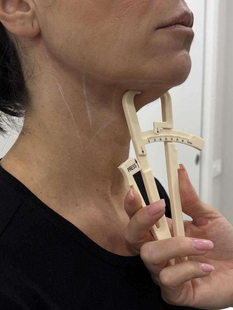 Cómo eliminar la flacidez en el cuello sin cirugía: Causas y tratamientos