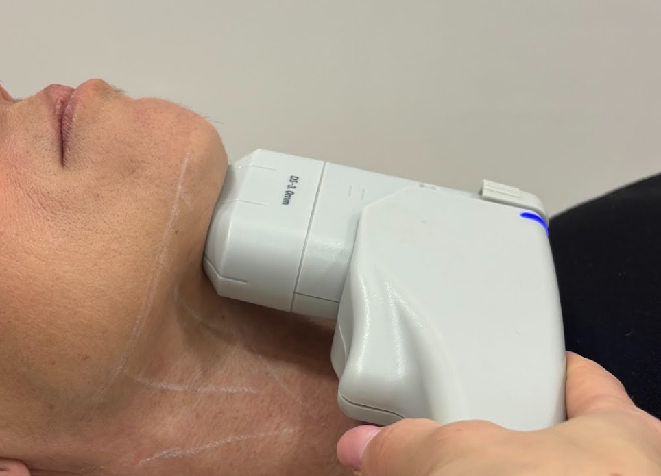 flacidez en el cuello