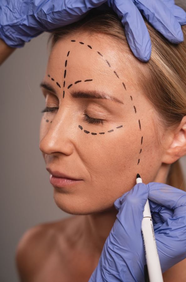 Armonización Facial: Qué Es y Cuánto Dura