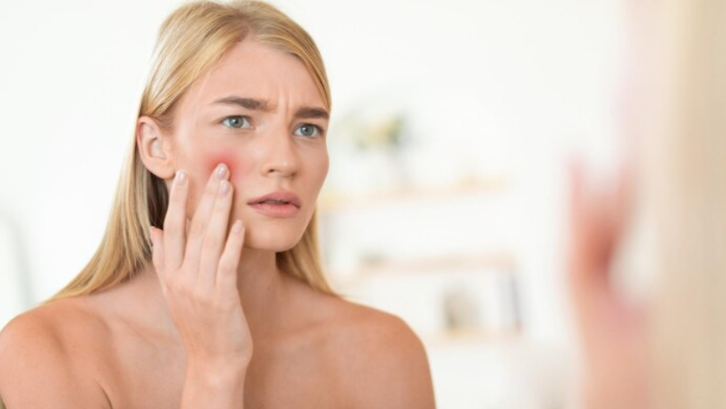 Piel Sensible: Causas, Cuidados y Tratamientos Médicos Efectivos