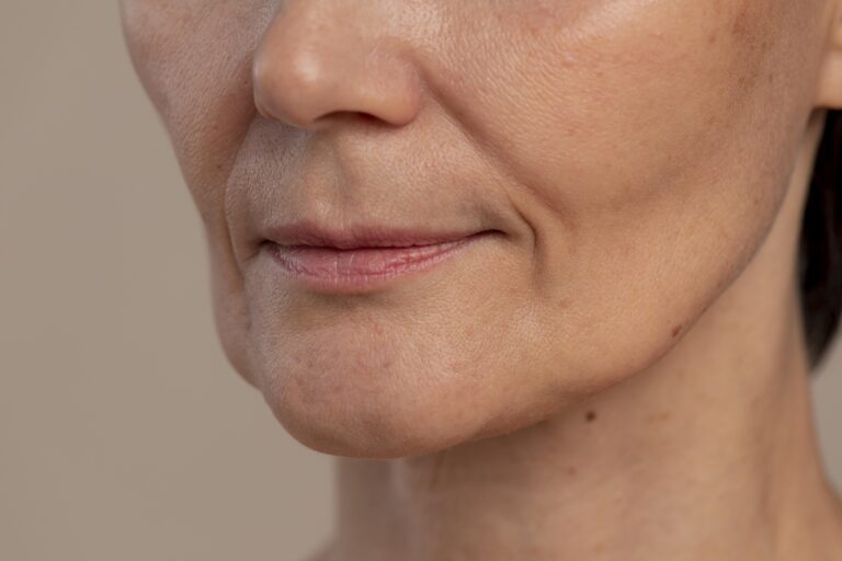 Mentón retraído: cómo mejorar el perfil facial sin cirugía